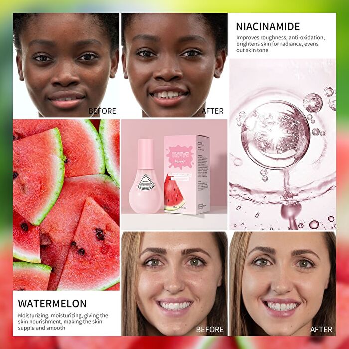 Watermelon Niacinamide Serum - 1pc - 75ml
