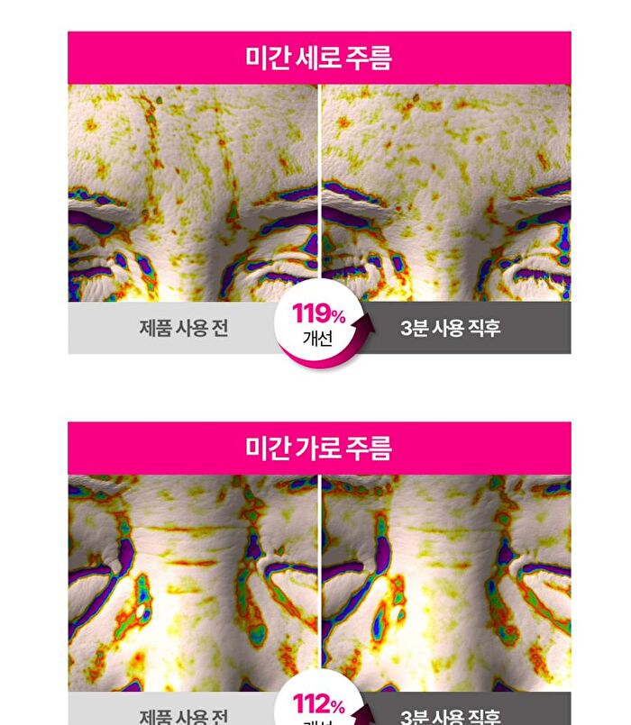 Isoi Bulgarian Rose Blemish Care Eye & Wrinkle Patch - 90 sheets