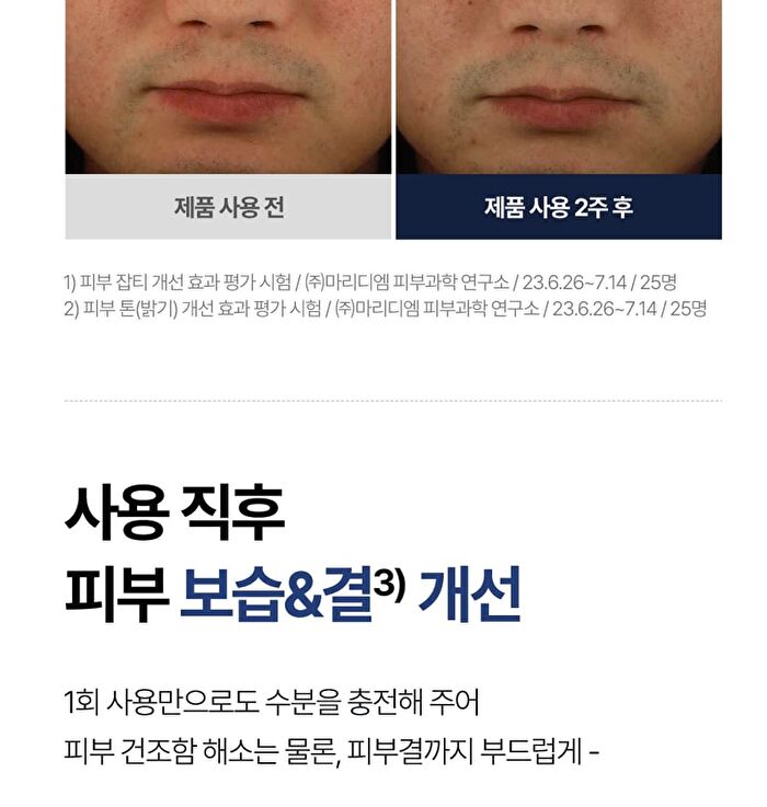 Isoi For Men Blemish Care All in one - 100ml