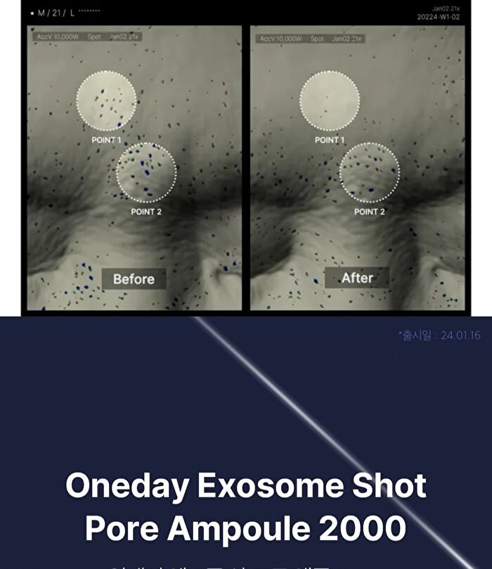One Day Exosome Shot Pore Ampoule 2000 - 30ml