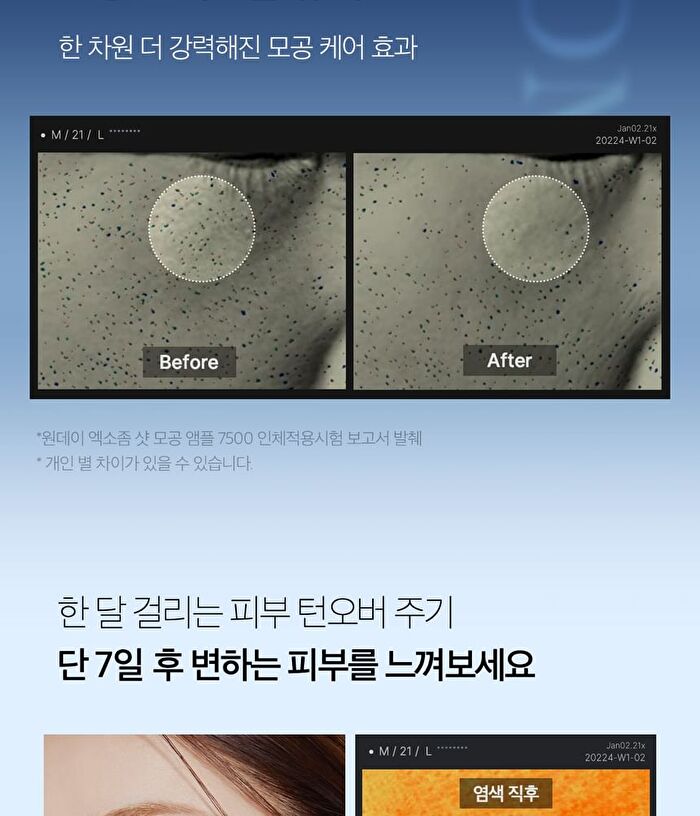 One Day Exosome Shot Pore Ampoule 7500 - 30ml