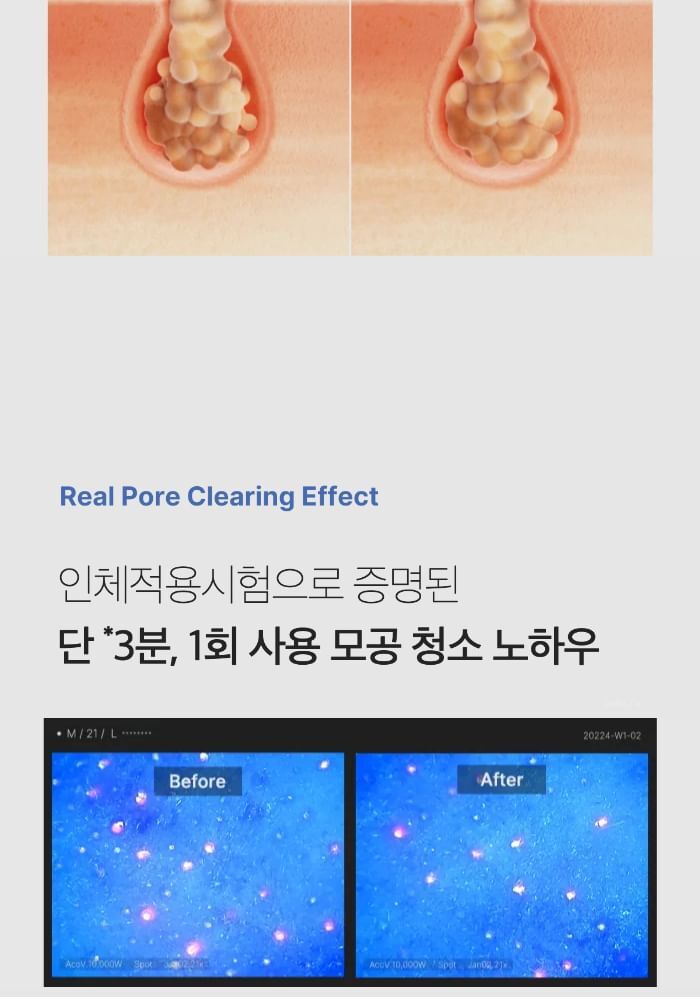 Zero Pore Blackhead Mud Mask - 100g