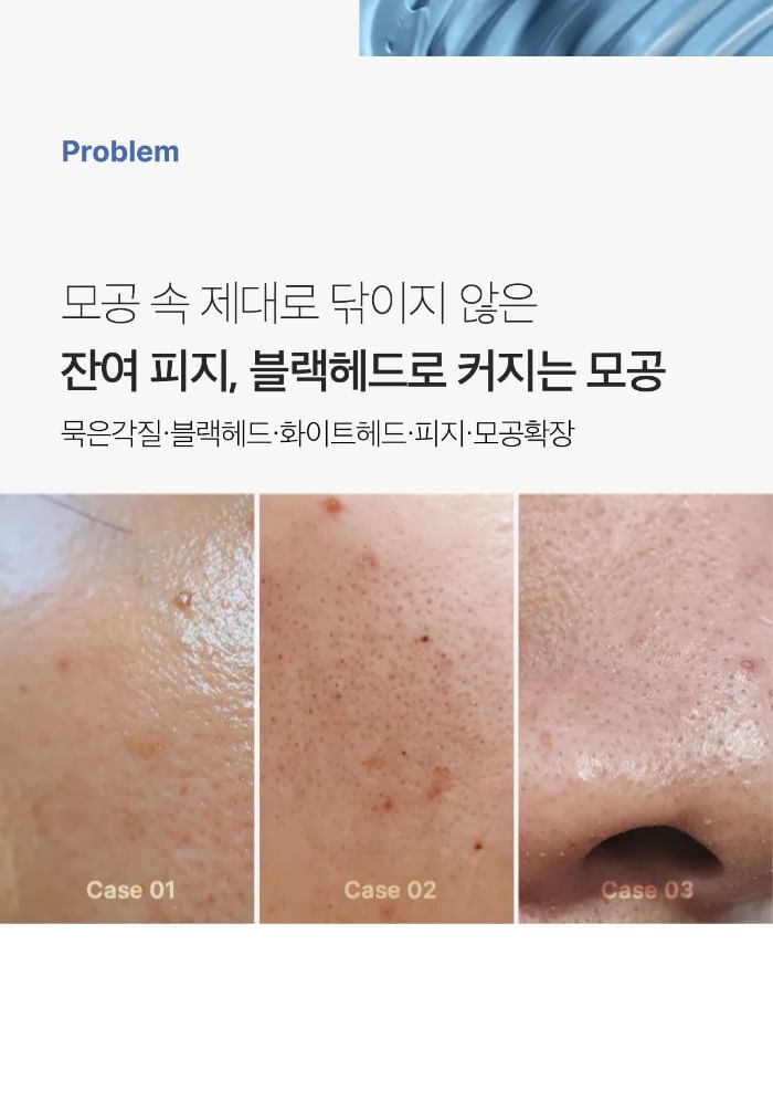 Zero Pore Blackhead Mud Mask - 100g