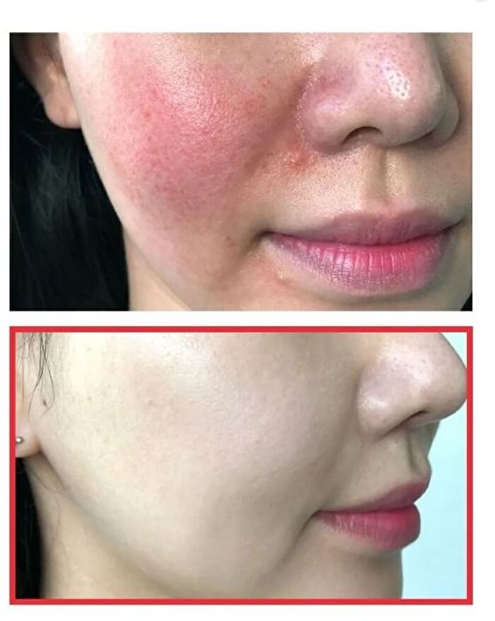 Snail Truecica Miracle Repair Toner - 2024 Version - 150ml