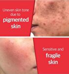 Snail Truecica Miracle Repair Toner - 2024 Version - 150ml