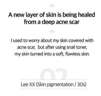 Snail Truecica Miracle Repair Toner - 2024 Version - 150ml