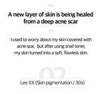 Snail Truecica Miracle Repair Toner - 2024 Version - 150ml