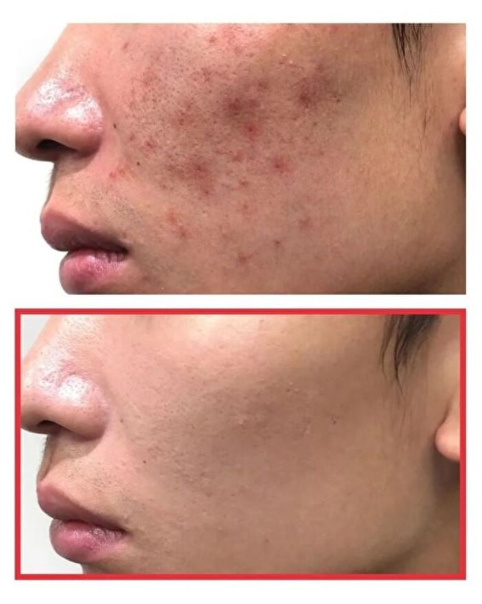 Snail Truecica Miracle Repair Toner - 2024 Version - 150ml