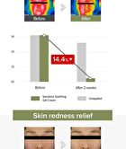 Soothing Gel Cream + Idebenone Blackberry Cream Duo Set - 2 pcs