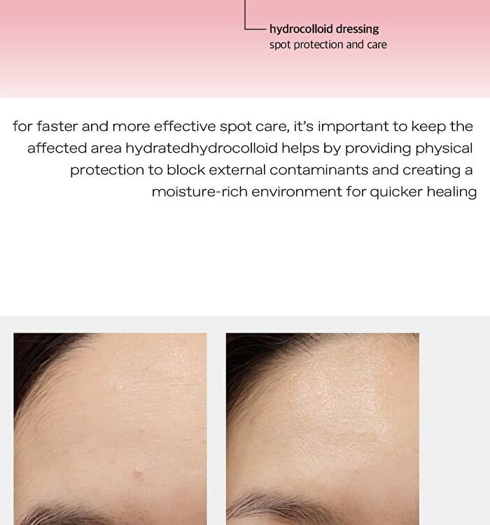 glow Diamond Drop Blemish Patch - 100 patches