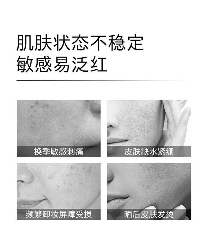 Ceramide Ectoin Ultra Moisturizing Cream (Travel Size) - Set (12.5g x 4pcs)