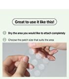 Fation Nosca9 Spot Patch - 102 patches