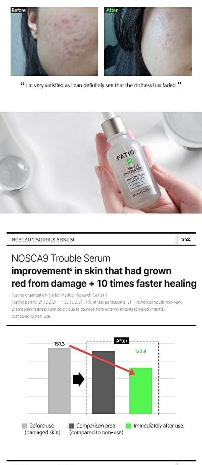 Fation Nosca9 Trouble Serum - 30ml
