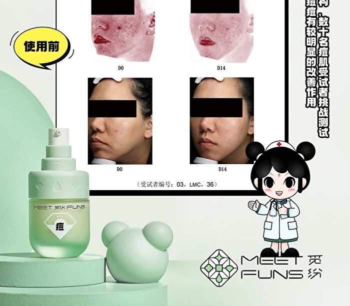 Meetfuns Refreshing Anti-Acne Serum - 35ml