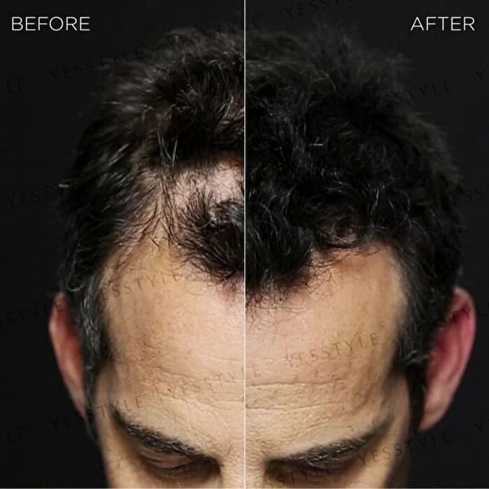 Hair Building Fibers - Dark Brown - 12g
