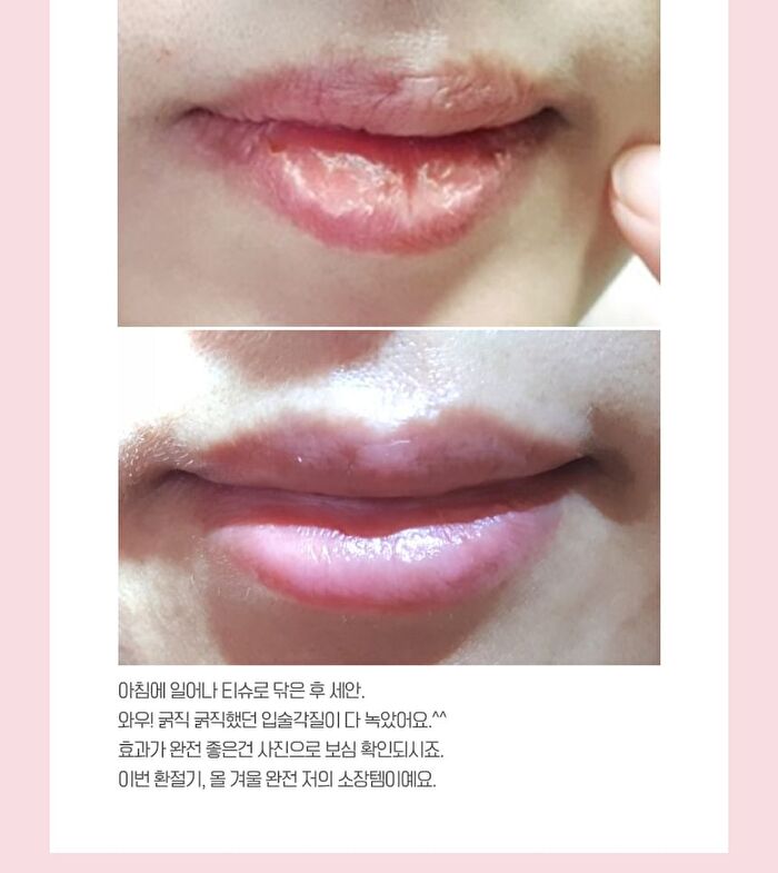Pomegranate Lip Night Mask Set - 5g x 3 pcs