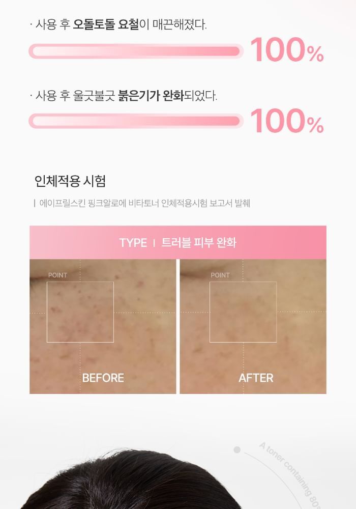 Aprilskin Pink Aloe Vita Toner - 250ml