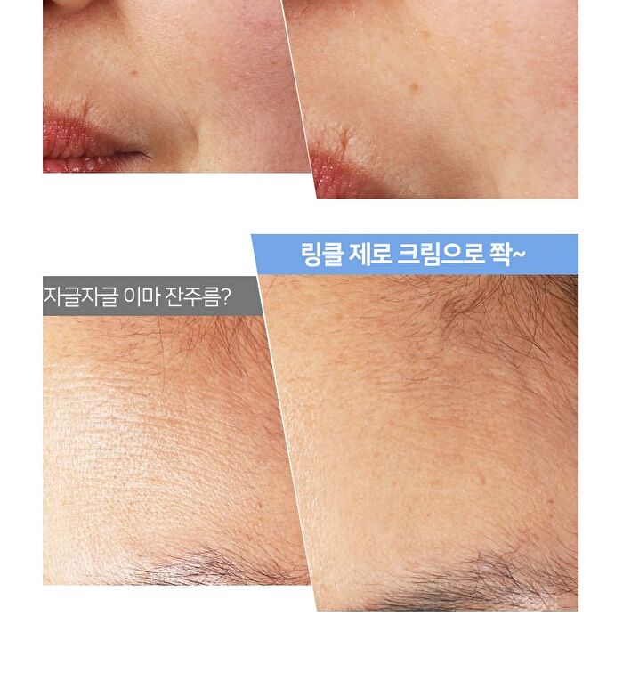 ARONYX Wrinkle Zero Cream - 2024 Version - 11ml
