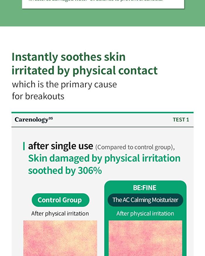 BE:FINE The AC Calming Moisturizer - 55g