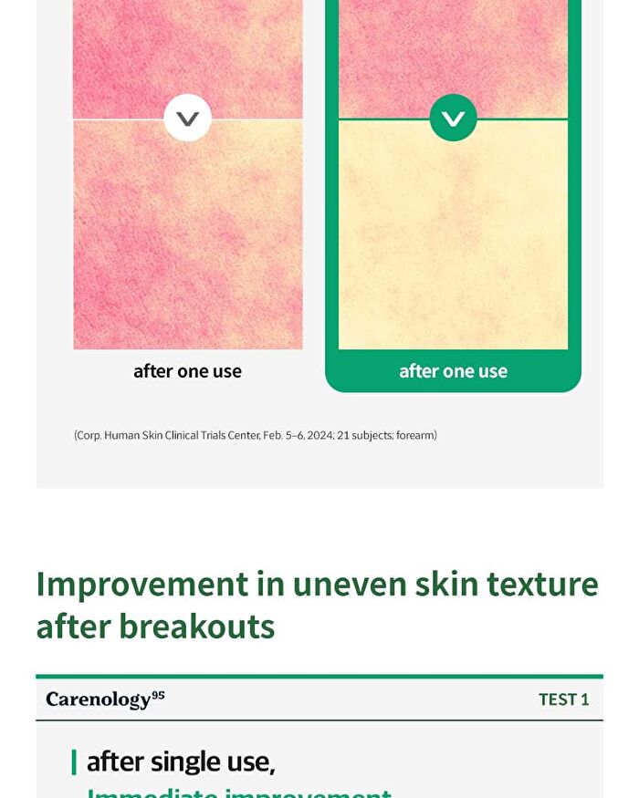 BE:FINE The AC Calming Moisturizer - 55g