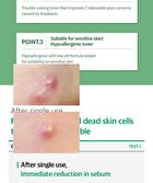 BE:FINE The AC Essence Toner - 150ml