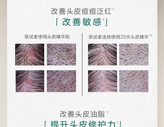 Chando Sensitive Scalp Repair Serum - 120ml