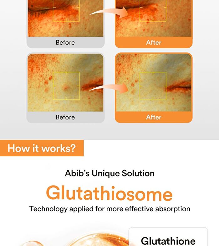 Glutathiosome Dark Spot Serum Vita Drop - 50ml