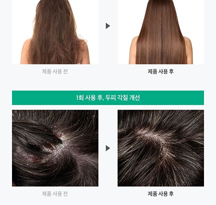 ALLMASIL Vegan 8 Seconds Scalp Hair-Loss Hair Mask Jumbo - 350ml