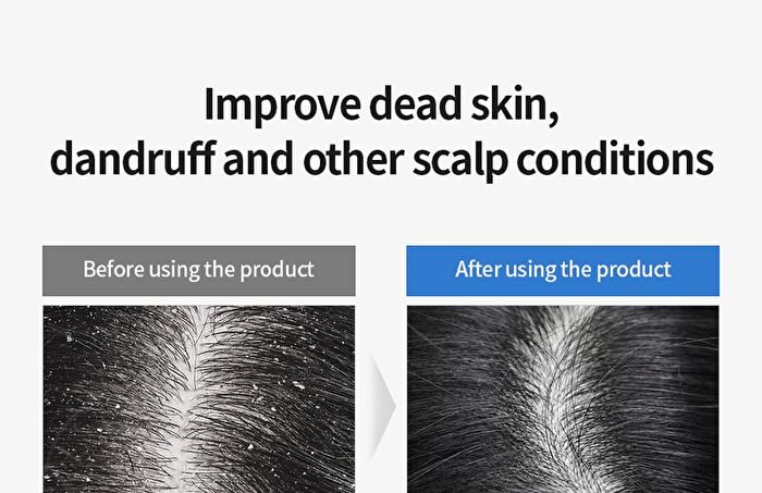 5 Probiotics Perfect Volume Shampoo Mini - 150ml