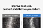 5 Probiotics Perfect Volume Shampoo Mini - 150ml