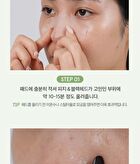 Witch Hazel Blackhead Cleaner Nose Pack Pad Set - 2 pcs