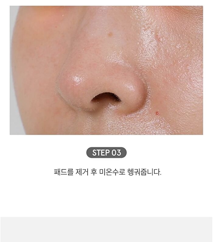 Witch Hazel Blackhead Cleaner Nose Pack Pad Set - 2 pcs