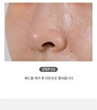 Witch Hazel Blackhead Cleaner Nose Pack Pad Set - 2 pcs