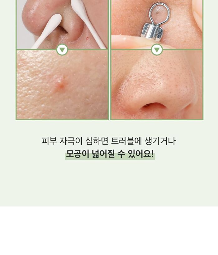 Witch Hazel Blackhead Cleaner Nose Pack Pad Set - 2 pcs