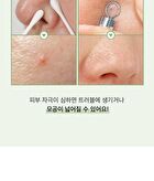 Witch Hazel Blackhead Cleaner Nose Pack Pad Set - 2 pcs