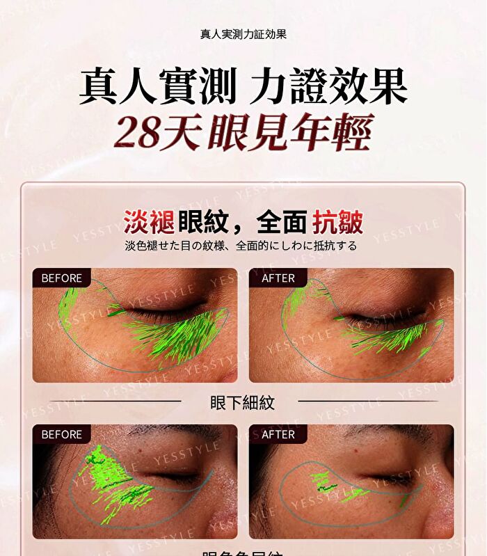 Dual-Probe Full Effect Periocular Anti-Aging RF Eye Massager Pro 4.0 - 1 set