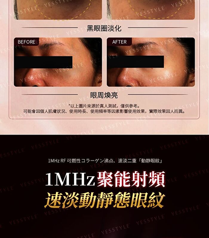 Dual-Probe Full Effect Periocular Anti-Aging RF Eye Massager Pro 4.0 - 1 set