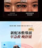 Dual-Probe Full Effect Periocular Anti-Aging RF Eye Massager Pro 4.0 - 1 set