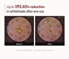 Peel Shot Exfoliant White Rice Ampoule - 80ml