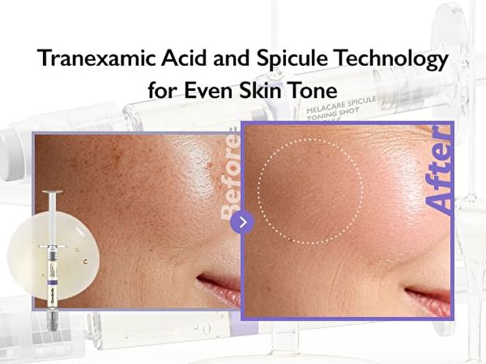 Melacare Spicule Toning Shot Ampoule Set - 3 pcs