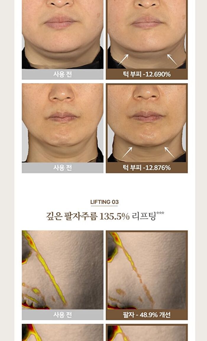 Begin Lift & Change Mask Set - 32g x 5 sheets