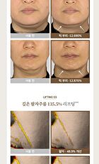 Begin Lift & Change Mask Set - 32g x 5 sheets