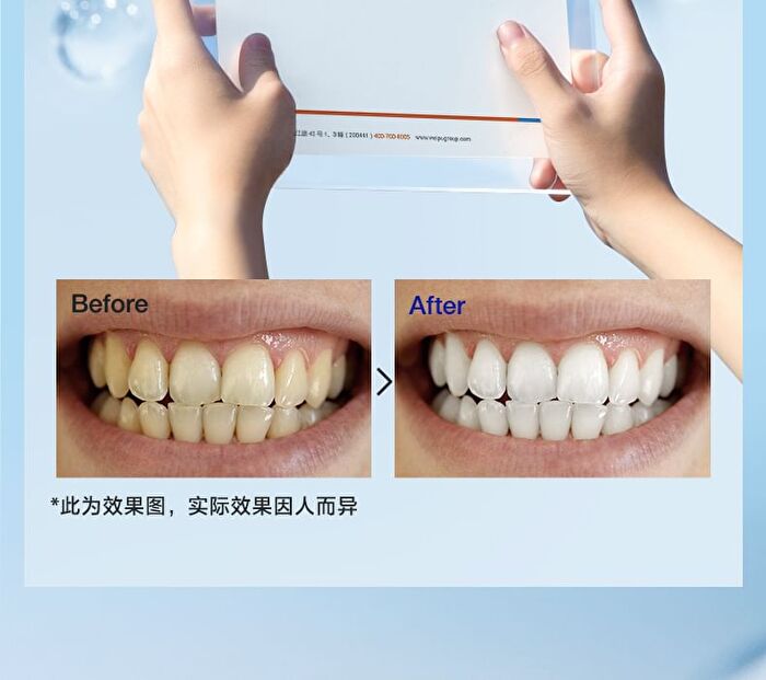Ice Sense Whitening Toothpaste - 100g