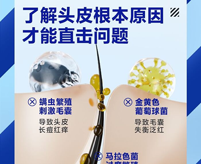 Water Oil-Control & Anti-Acne Shampoo - 400ml