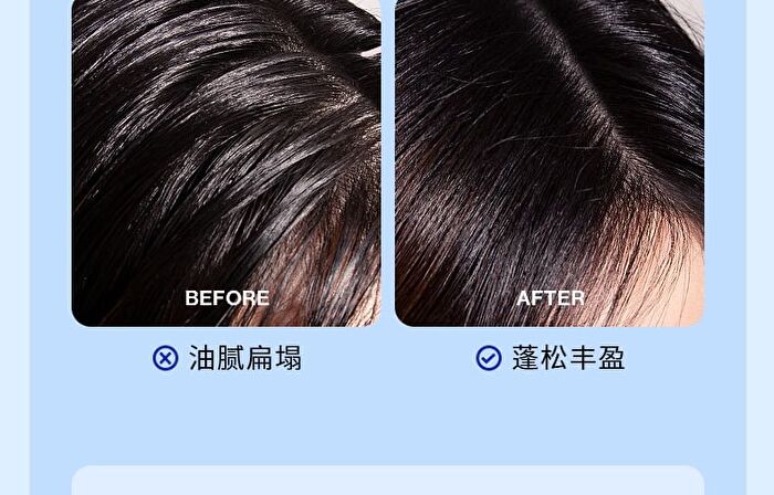 Ehd Oil Control And Anti-Dandruff Shampoo - 500ml