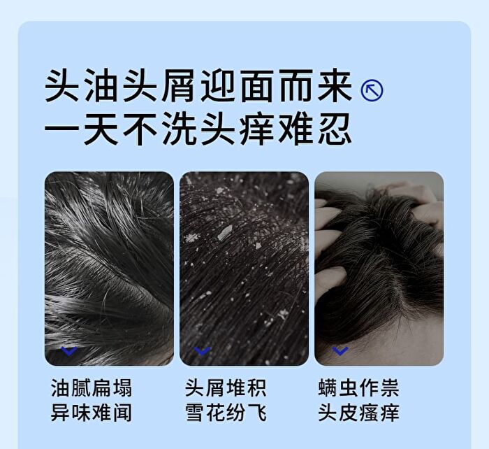 Ehd Oil Control And Anti-Dandruff Shampoo - 500ml