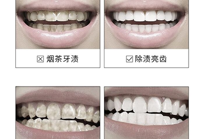 Ehd Whitening Tooth Cleaning Powder - 50g