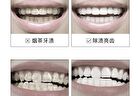 Ehd Whitening Tooth Cleaning Powder - 50g