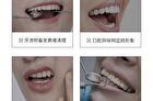 Ehd Whitening Tooth Cleaning Powder - 50g