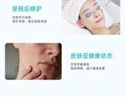 Ectoin Oil Control Soothing Sensitivity Repair Cream (Trial Size) - 1pc - 15g